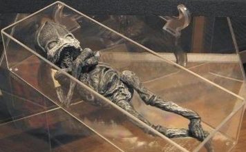 Кыштымский карлик: разгадка тайны Алёшеньки Кыштымский карлик, Алешенька